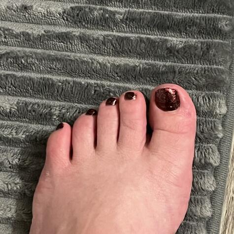 Opulent Tiptoes